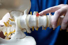 physiotherapist spinal care